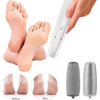 Rechargeable Foot Smoother with LED Guidance and Custom Speeds
